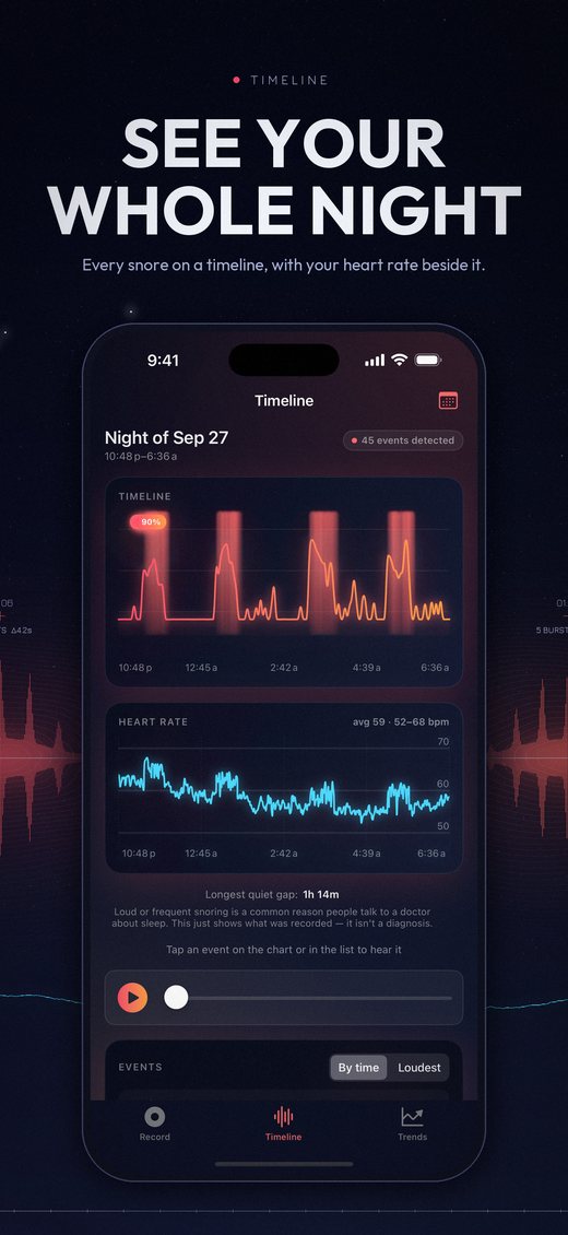 Timeline: the night's loudness waveform with snoring highlighted, and Apple Watch heart rate below